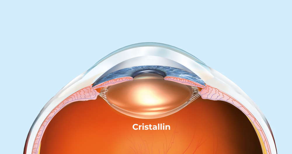 surgery-cataract-crystalline-eye-ophthalmology-center-valence Cataract surgery at the Centre Ophtalmologique de Valence.